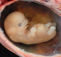 Menschlicher Embryo in 6. Schwangerschaftswoche