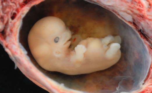 Wunderwerk Embryo Foten Haben Schon Fruh Schmerzempfinden